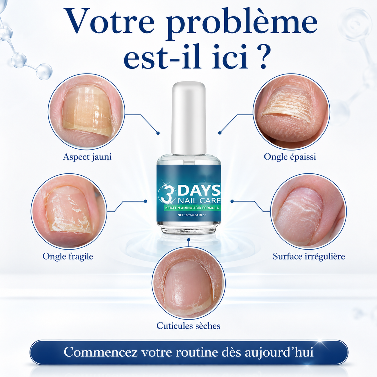 💅 Dites STOP aux ongles cassants !