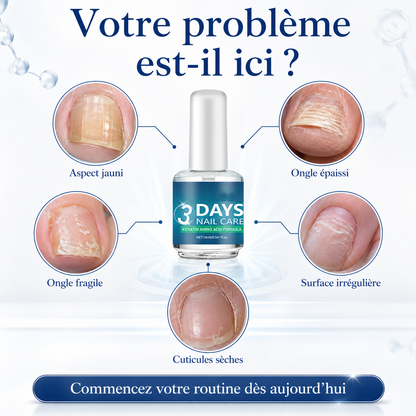 💅 Dites STOP aux ongles cassants !