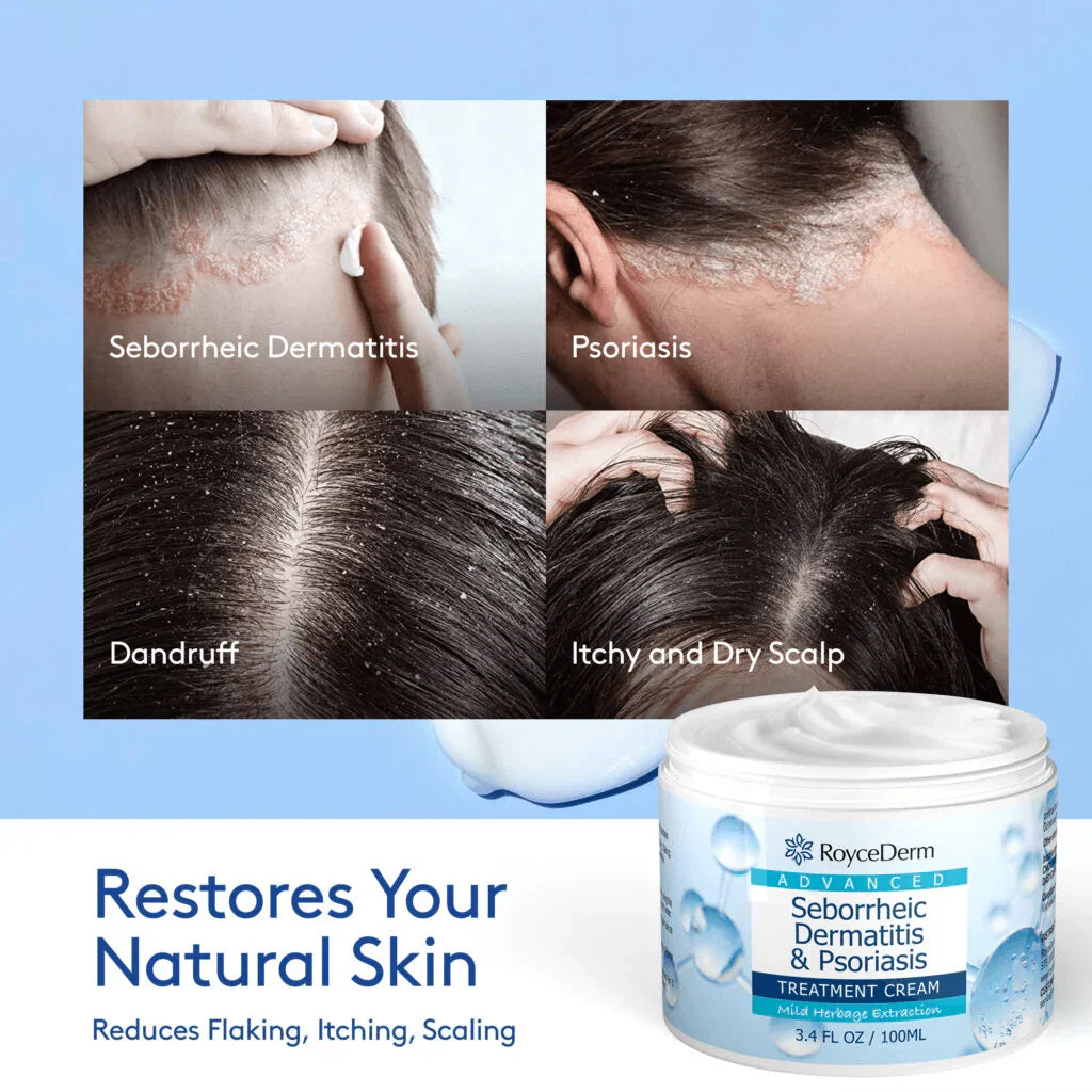 RoyceDerm - Seborrheic Dermatitis & Psoriasis Cream