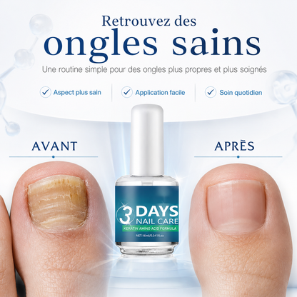 💅 Dites STOP aux ongles cassants !