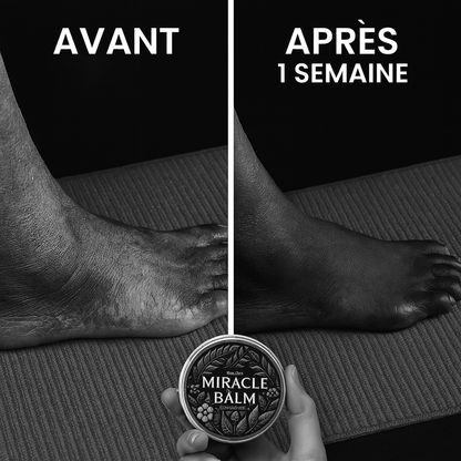Miracle Balm – Soulage varices, jambes lourdes, douleurs et brûlures aux pieds, neuropathie dès la première application.